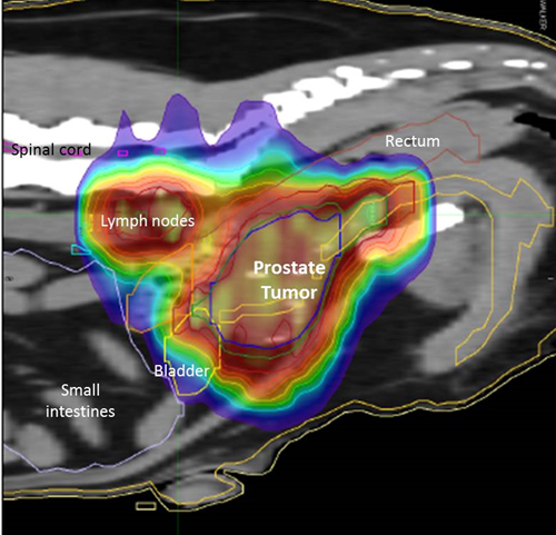 An x-ray of a dog's prostate tumor with radiation doses depicted by different colored lines surrounding the tumor